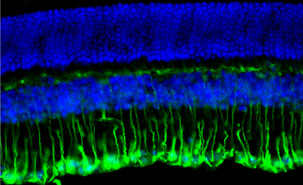 La rétine de l'œil est composée de six couches de cellules, dont les cellules gliales de Müller (en vert) et les cellules du noyau de la rétine (en bleu). Crédit : Jessica Agostinone, CRCHUM.